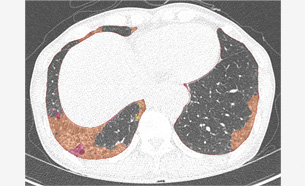 Radiology: Cardiothoracic Imaging