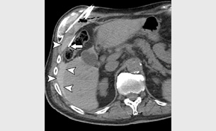 an image from the article by Thurlow et al