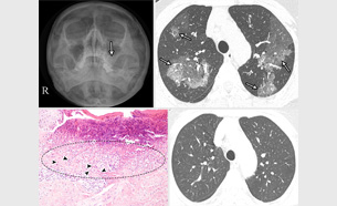 an image from the article by Yoo et al
