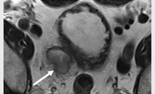 an image from the article by Karajgikar et al
